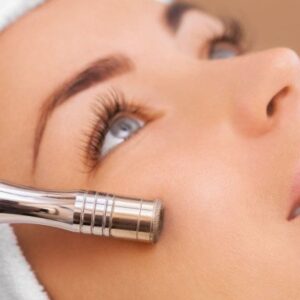 microdermabrasion treatments in Middlesbrough