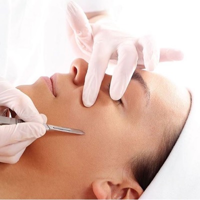 Dermaplaning at Emporium Salon Middlesbrough Dermaplaning at Emporium Salon Middlesbrough