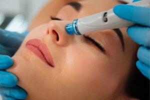 Hydrofacial Middlesbrough