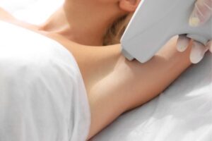 laser hair removal Middlesbrough (1)